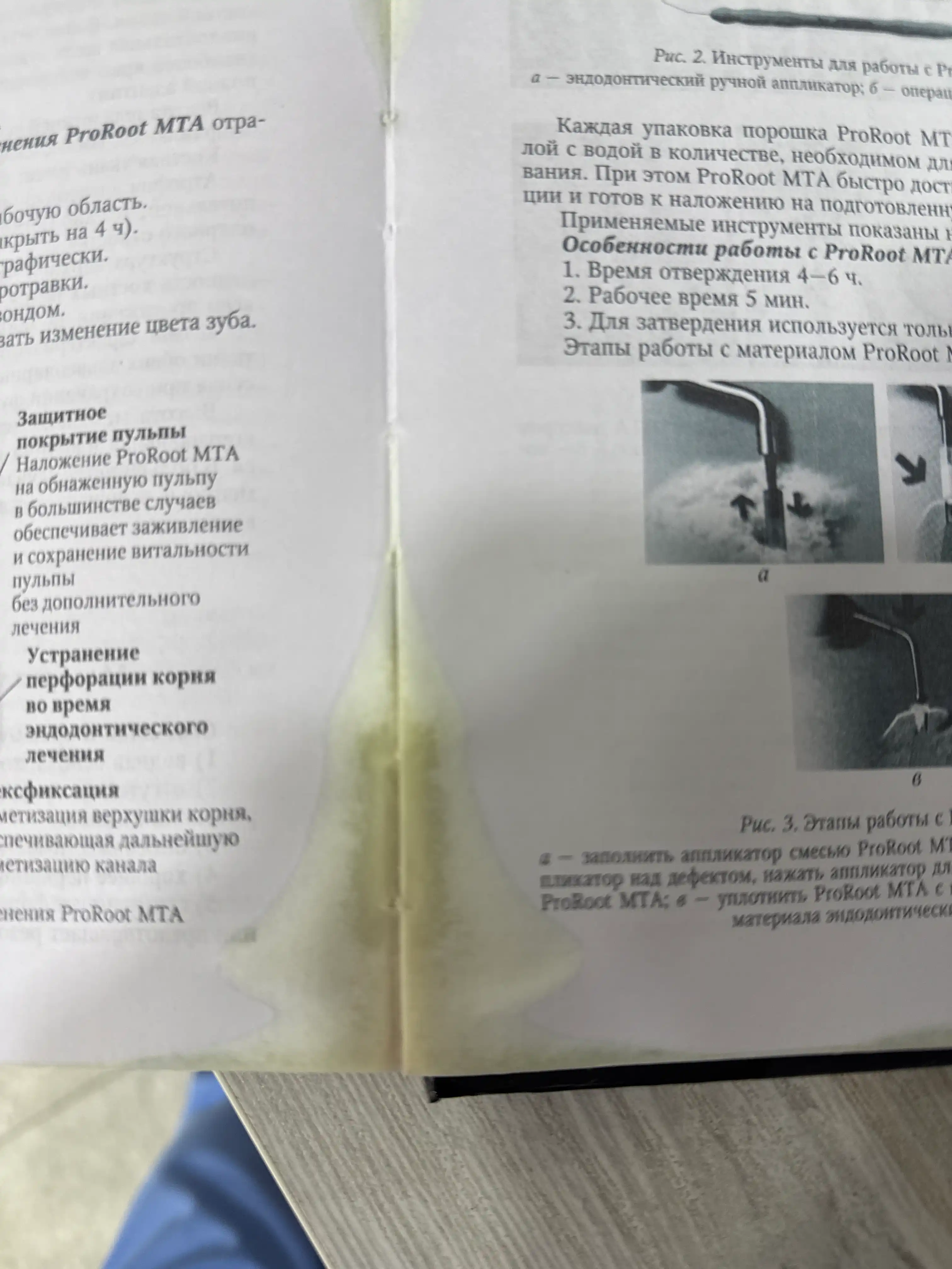Sovremennyye podkhody k endodonticheskomu lecheniyu zubov