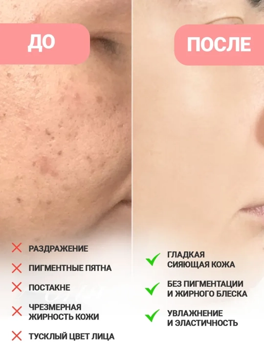 Anua, Осветляющая сыворотка для лица с ниацинамидом Anua Niacinamide 10% + TXA 4%, 30 мл