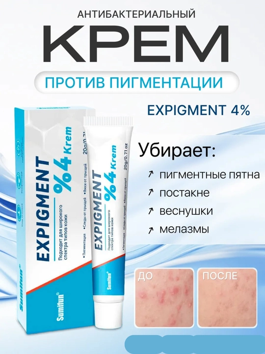 Крем отбеливающий Expigment 4%, мазь для лица от пигментации мелазмы и веснушек, 30 г - 