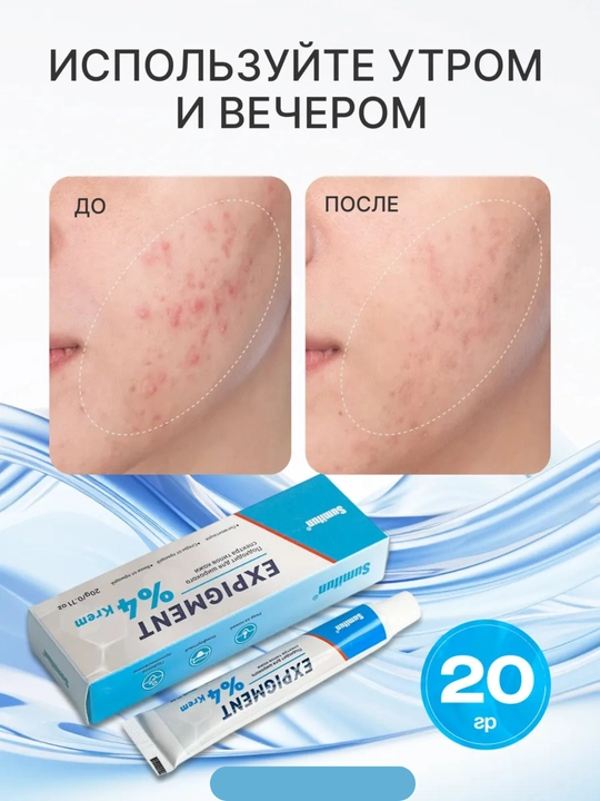 Oqartiruvchi Expigment 4% kremi, yuz uchun pigmentatsiya, melazma va sepkillarga qarshi malham, 30 g