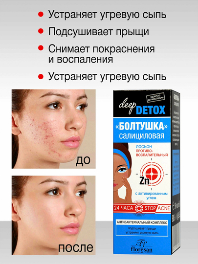 Противовоспалительный лосьон Floresan, Deep detox, 50 мл