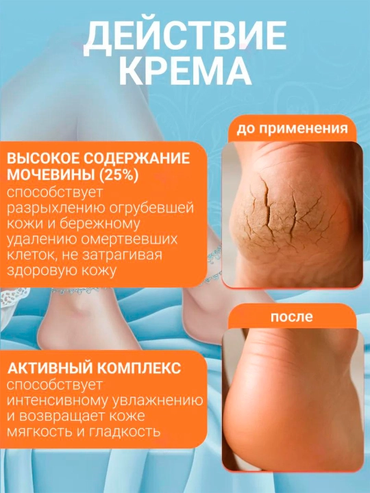Qayta tiklovchi krem Floresan Кеrатоderm Urea 25% F-618, 100 ml