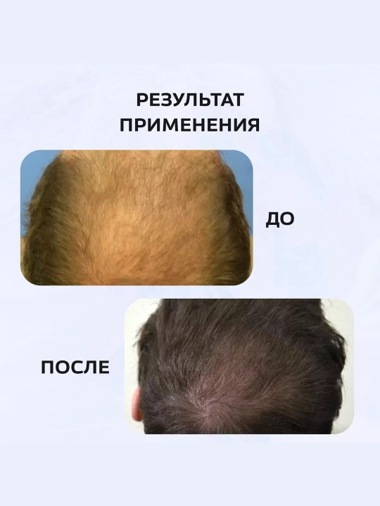 Горячая маска-компресс активатор роста волос Floresan репейник, 450 мл