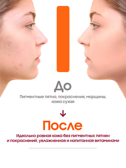 Сыворотка для кожи лица от пигментации и постакне ZODIAC, витамин C, против морщин, 30 мл