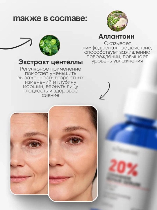 KORMESIC набор увлажняющих сывороток для лица, осветление, от морщин