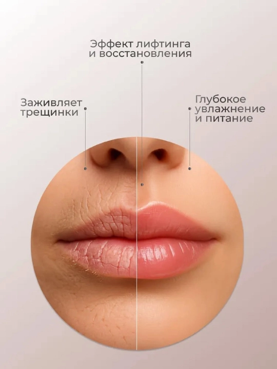 Маска для губ ZOZU, 40 шт, увлажняющие патчи для губ, Корейская формула