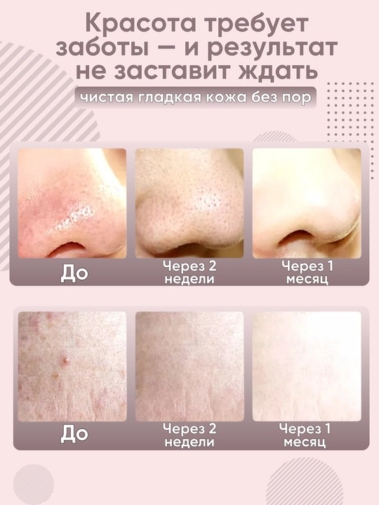 Mikrotoklar va ion terapiyasi bilan yuz uchun ultratovushli skraber