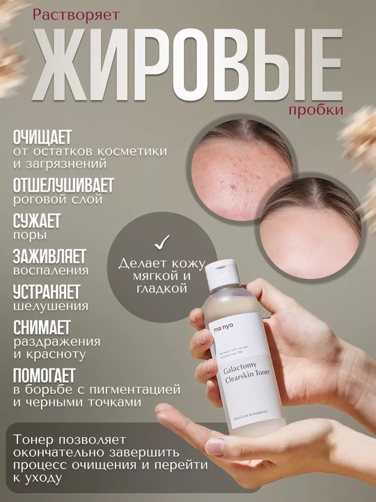 Тонер для лица, Manyo, Galactomy Clearskin, Blackhead & Pore, Galac Whitening Vita