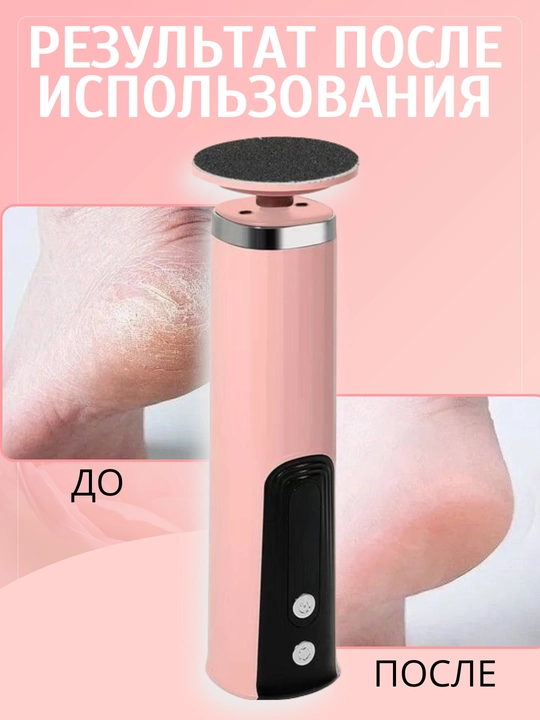 Pemza fayli poshnalar, oyoqlar uchun elektrdir. 6 tezlik, qo'shimchalar kiritilgan