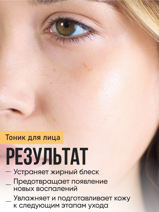 Набор для идеальной кожи FRESH LOOK, гель масло, тоник для лица матирующий