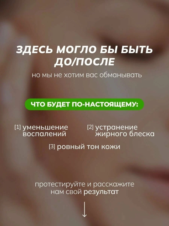 Сыворотка для лица от прыщей, воспалений, акне, жирности, чёрных точек, комедонов Art&Fact