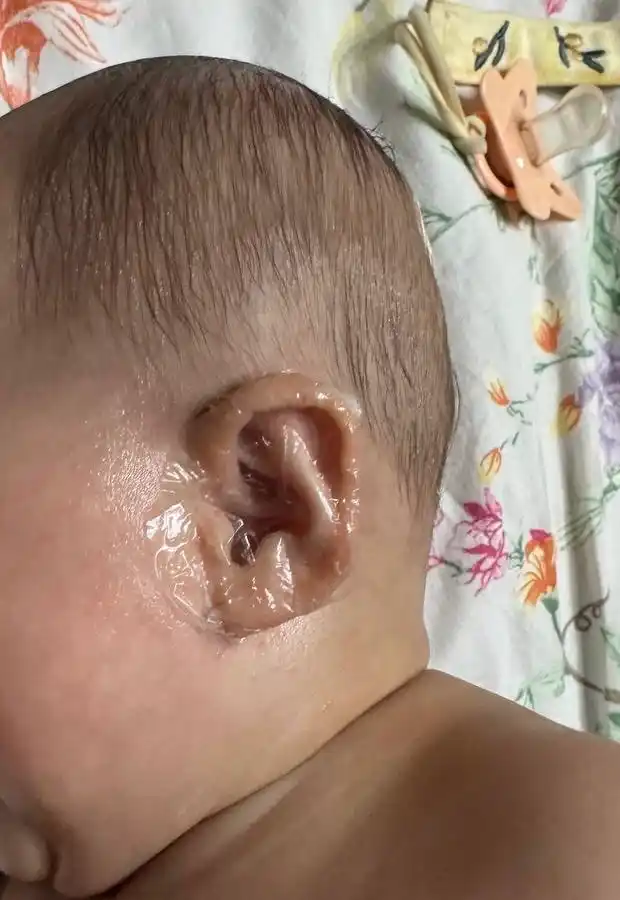 Специальные наклейки для детских ушей, 30 шт, защита ушей при купании