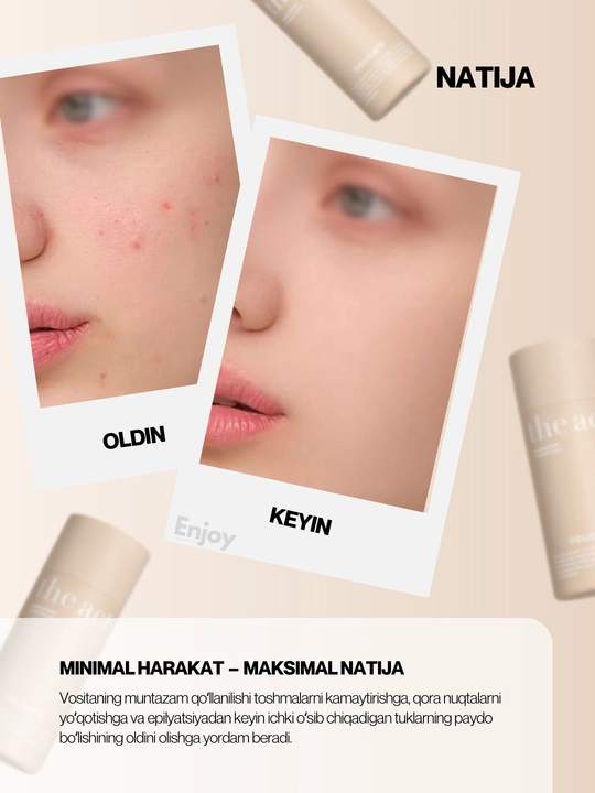 Yuz va tanani yuvish va tozalash uchun enzimli pudra The Act, ugriga qarshi