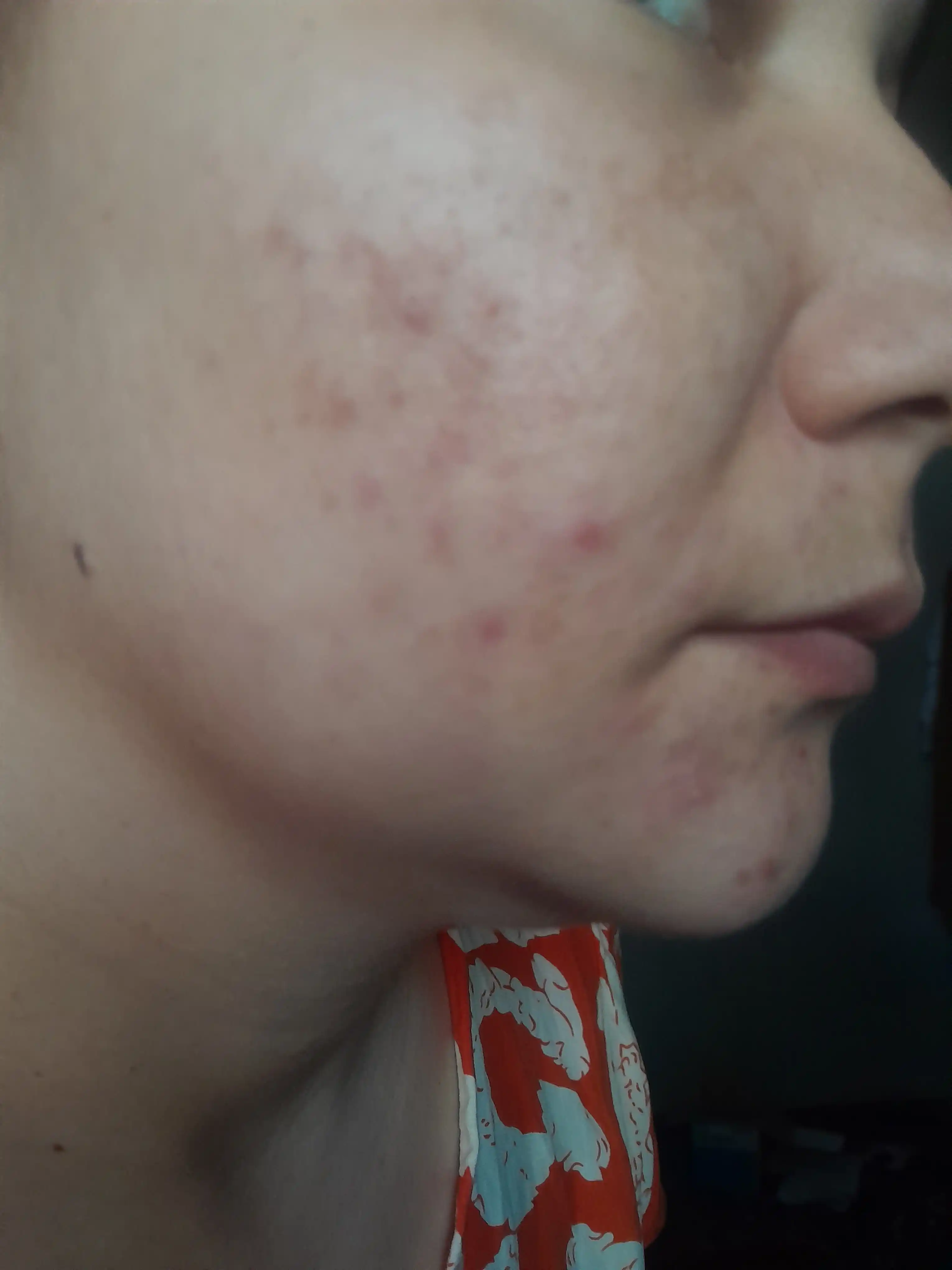 Antioksidantli zardob-eliksir Floresan Cosmetic Vitamin C, 30 ml