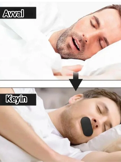 Mouth tape, пластырь для сна против храпа и сухости во рту, 30 шт — SHOH1-2TAPE-ЧЕРН