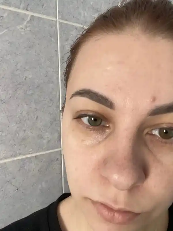 Крем для кожи вокруг глаз LYDIMOON Retinol Essence устраняет темные круги и морщины, 35 г