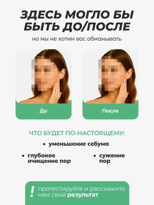 Гель-пенка для умывания от жирности, прыщей, угрей, воспалений, акне, матирующая Art&Fact