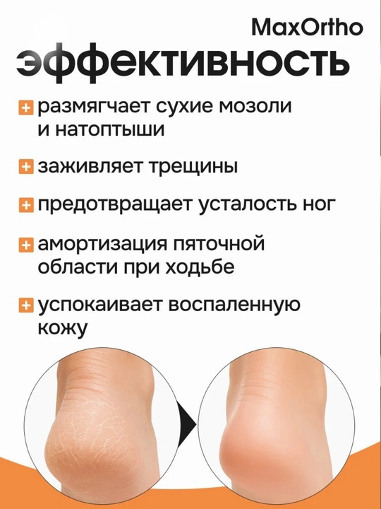 Напяточники с силиконовой вставкой, косметические носочки для ухода за пятками, 2 шт