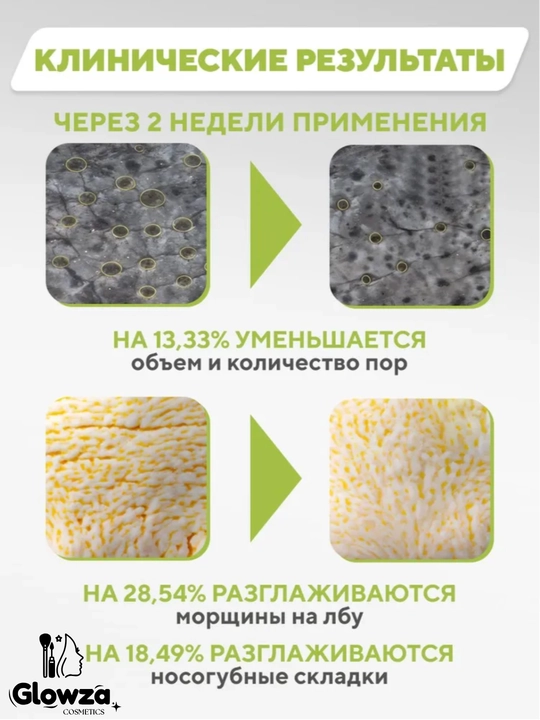 Лифтинг крем для лица Celimax, с микроиглами и ретинолом