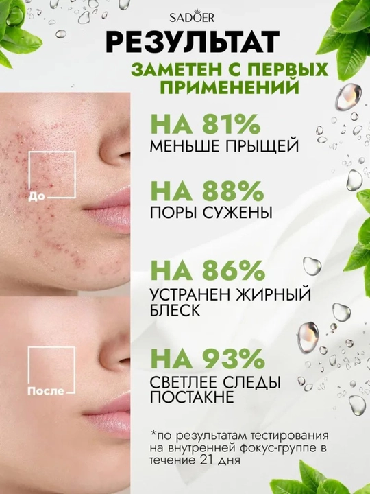 Крем от прыщей для проблемной кожи, точечный, 20 мл