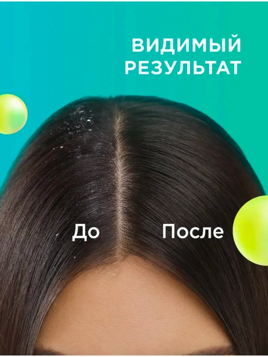 MY MUSE kosmetik soch turmagi to‘plami, sovg‘a sifatida, 250 ml