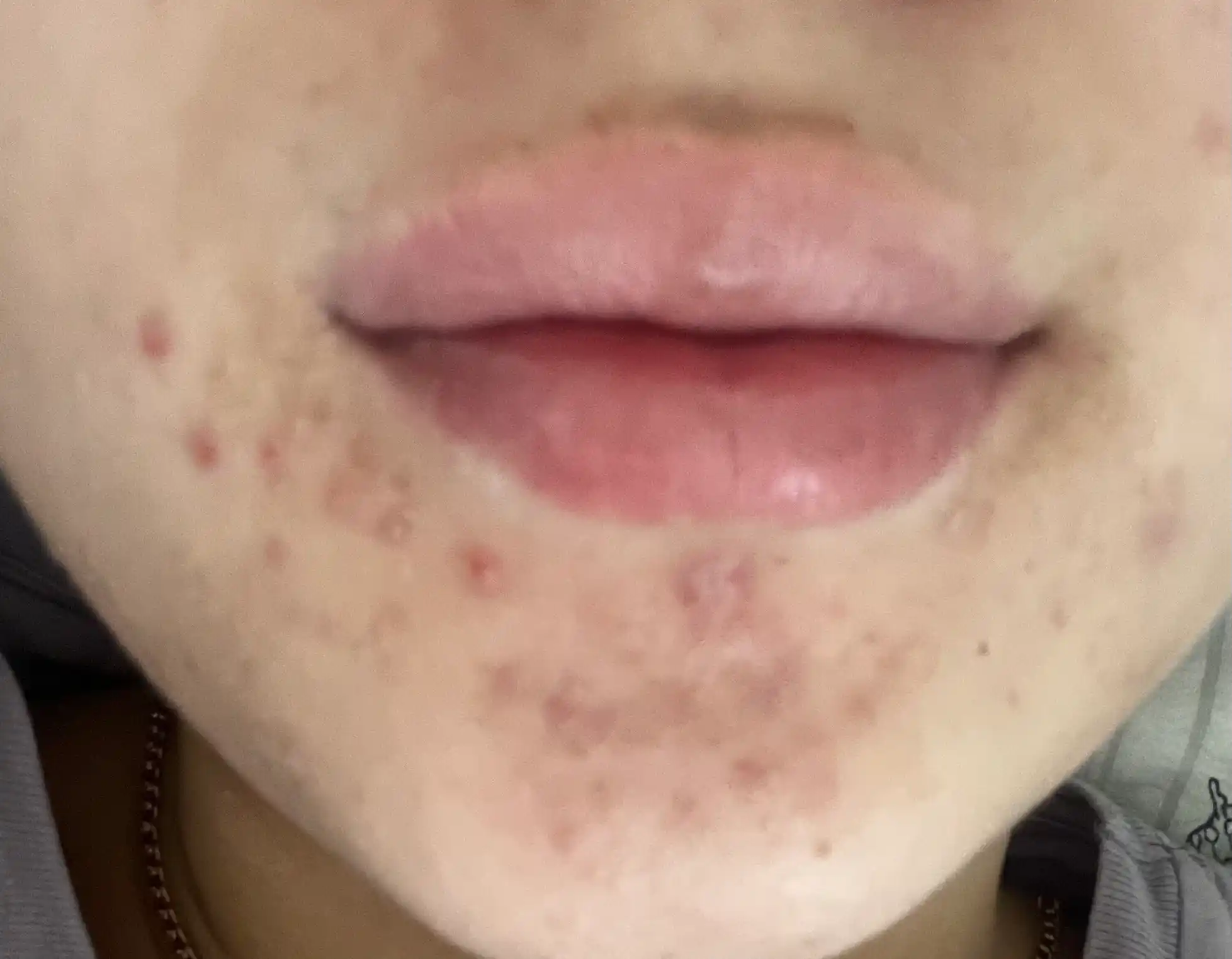 SPF-stik yuz va tana uchun quyoshdan himoya qiluvchi va namlantiruvchi SPF50+