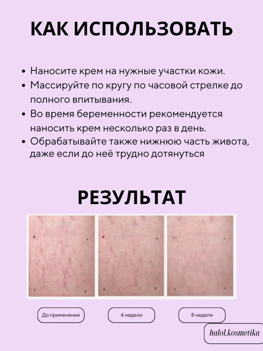 Naturavita (Растяжки) Крем против растяжек