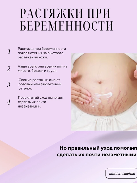 Naturavita (Растяжки) Крем против растяжек