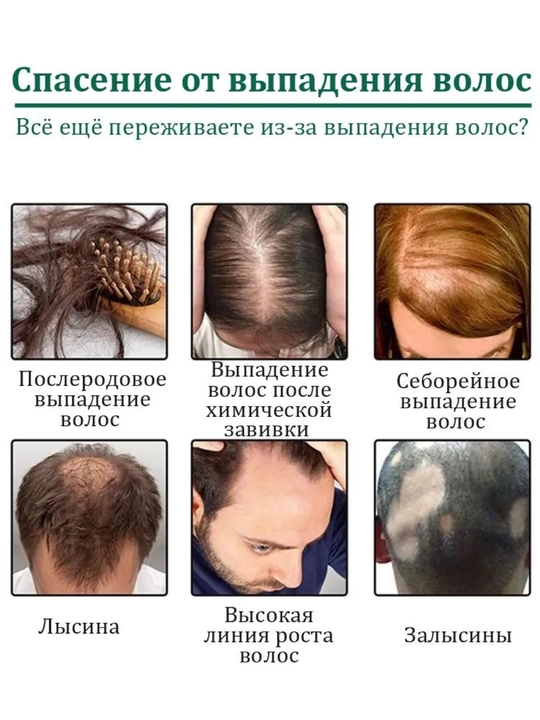 Спрей от выпадения волос, стимулирует рост, питает волосы, 120 мл