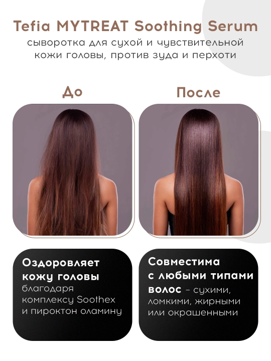 Zardob nozik yoki quruq bosh terisi uchun himoya TEFIA MY TREAT, 120 ml, namlantiradi