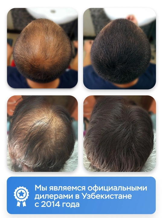 Загуститель для волос от Caboki ECO, для всех типов волос, 25 гр