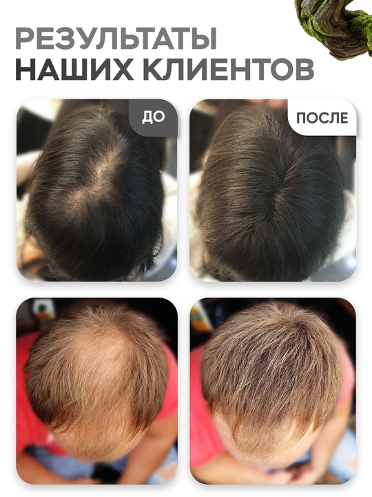 Загуститель для волос от Caboki ECO, для всех типов волос, 25 гр