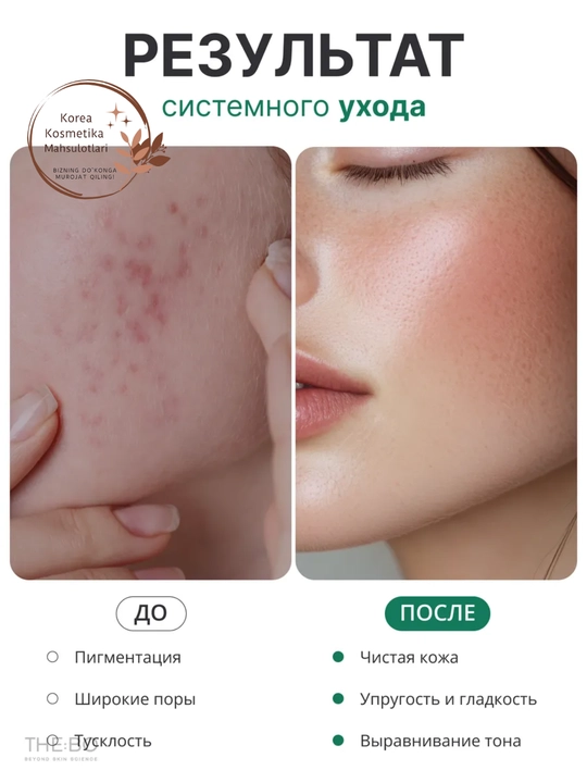 Axis-Y Dark Spot Correcting Cream - крем против тёмных пятен и неровного тона кожи, 50 мл