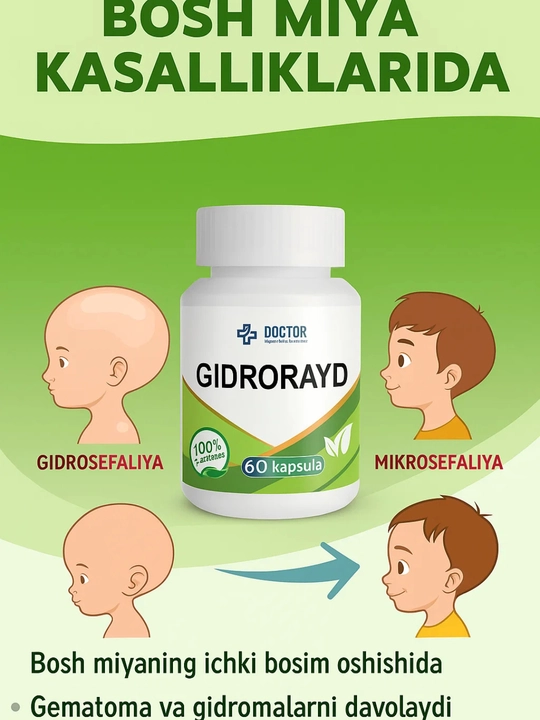 GIDRORAYD  gidrosefaliya mikrosefaliya