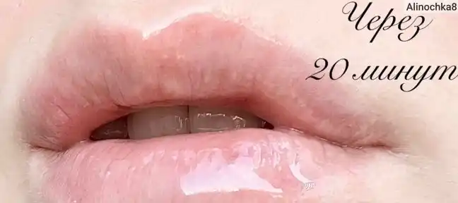 Плампер для губ VT Cosmetics Reedle Shot: объем с микроиглами, блеск и тинт, 6 видов