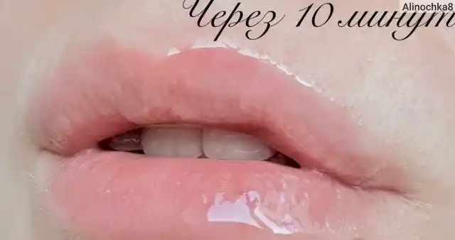 Плампер для губ VT Cosmetics Reedle Shot: объем с микроиглами, блеск и тинт, 6 видов