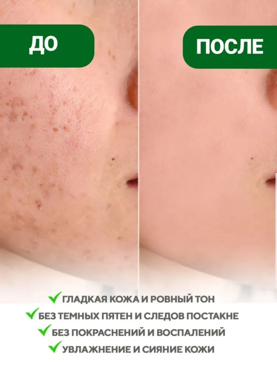 AXIS-Y qora dog'larni to'g'rilovchi zardob, 50 ml