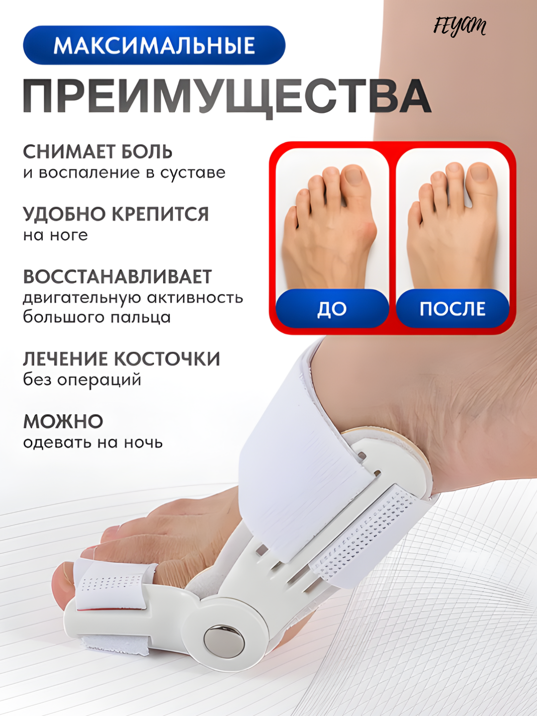 Hallux Valgus valgus spalni, bosh barmoq korrektori, oyoqlar uchun - 
