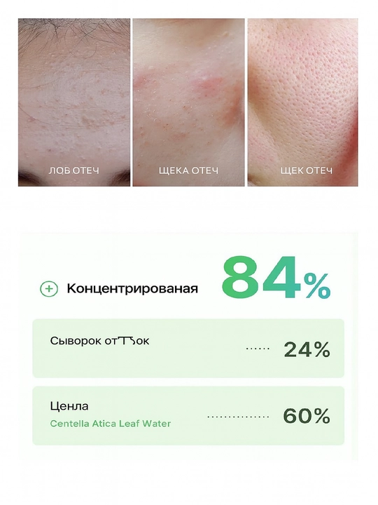 MEDICUBE EXOSOME CICA AMPOULE Восстанавливающая ампула с центеллой и экзосомами