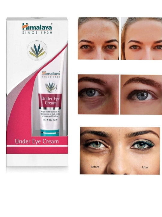 Himalaya Under Eye Cream крем омолаживающий, против морщин вокруг глаз  - 