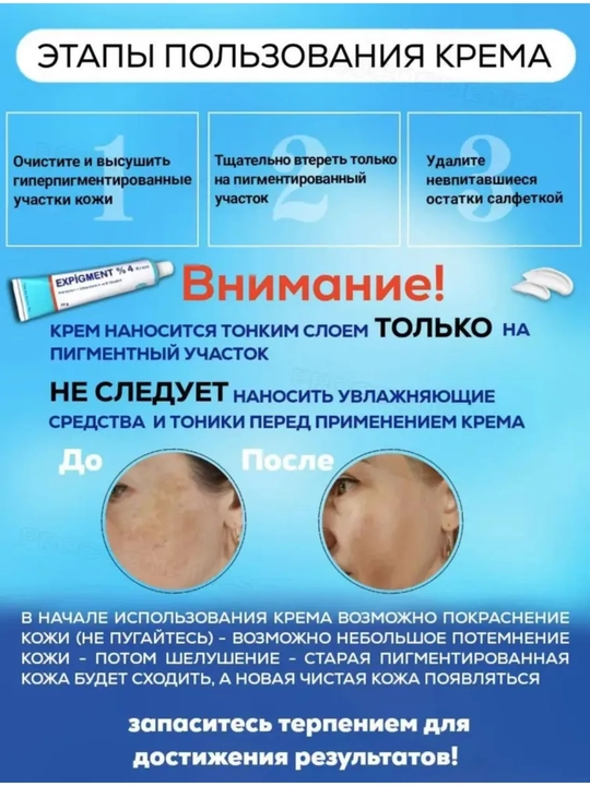 Крем отбеливающий, мазь для лица от пигментации "мелазмы" и веснушек Expigment 4%, 30 г