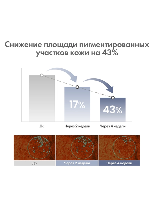 AXIS-Y TXA 2.5% yorug‘lantiruvchi krem teri rangini bir xillashtiradi va yaltirash beradi