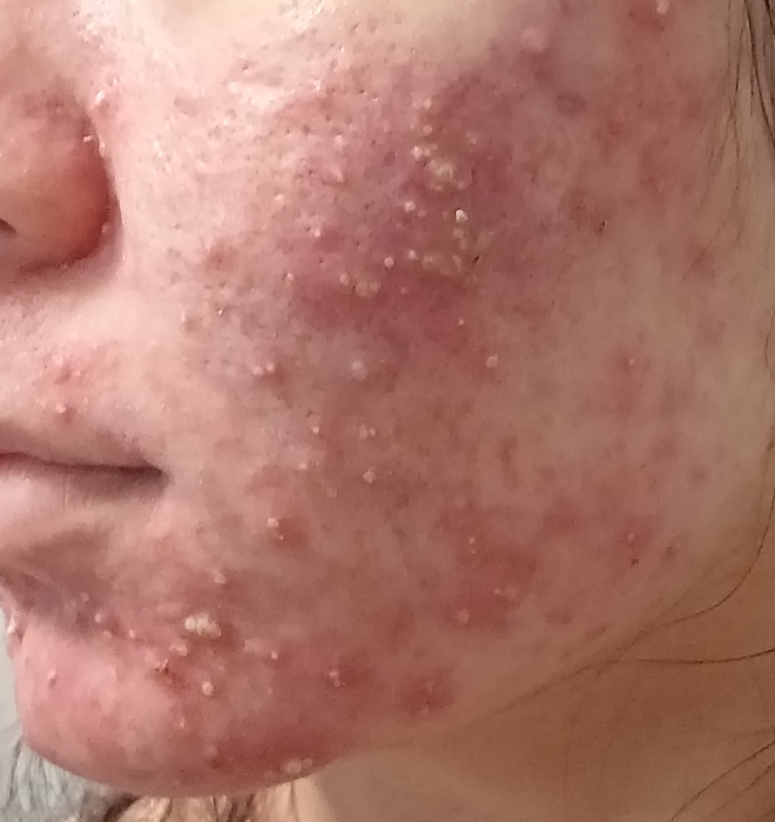 Гель очищающий LA ROCHE-POSAY EFFACLAR, пенящийся для чувствительной жирной кожи лица и тела, 200 мл