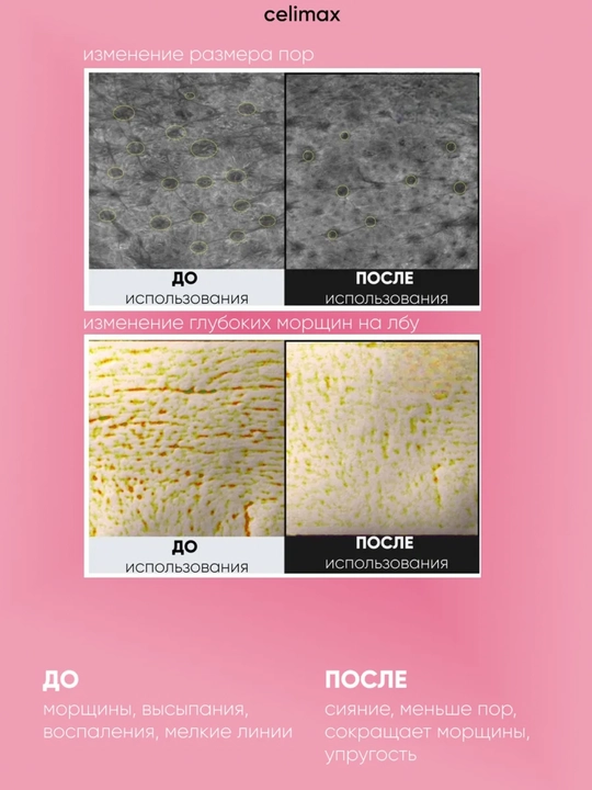Celimax Retinol Shot лифтинг-бустер и сыворотка, c ретинолом и микроиглами