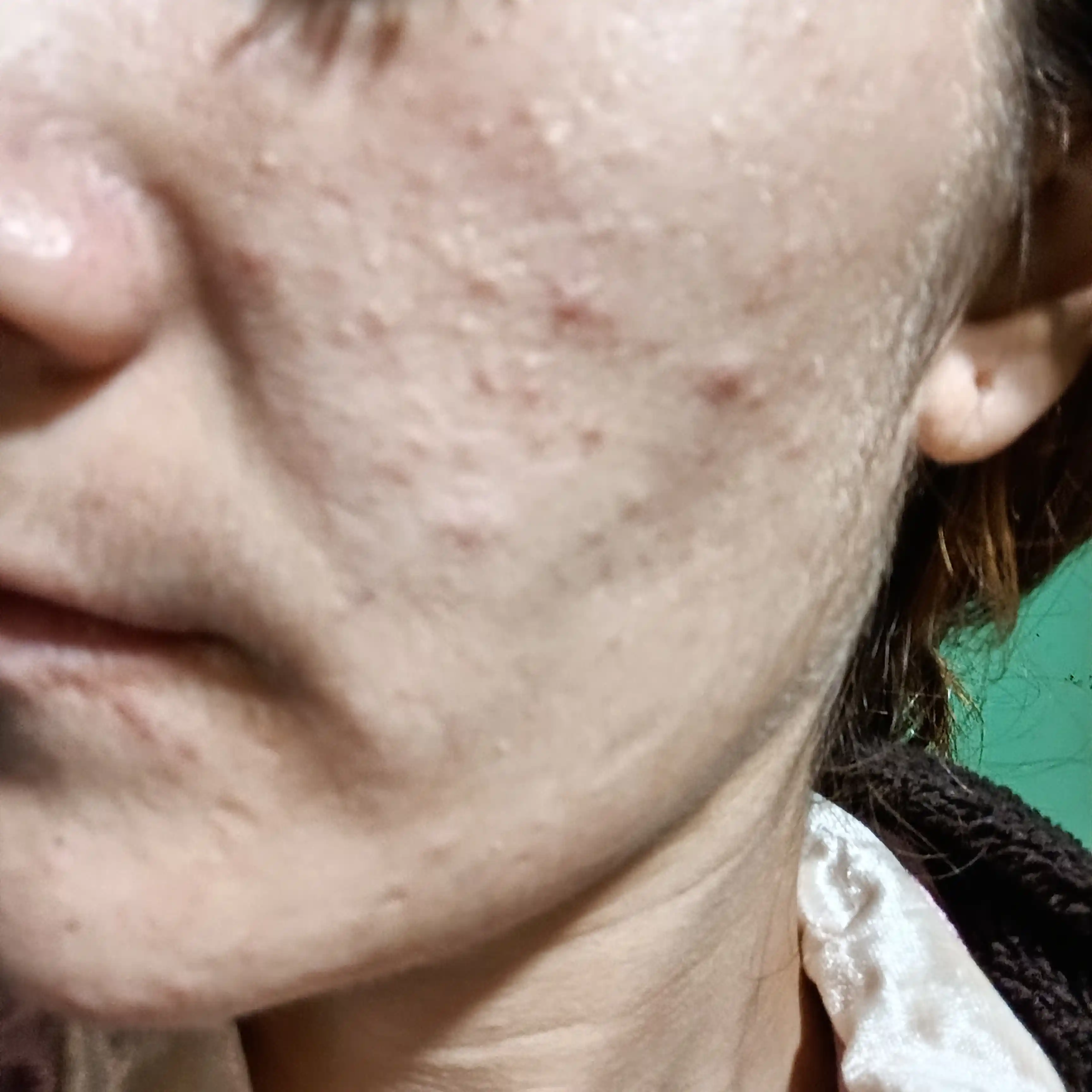 Сыворотка для лица, сужающая поры и разглаживающая, 30 мл