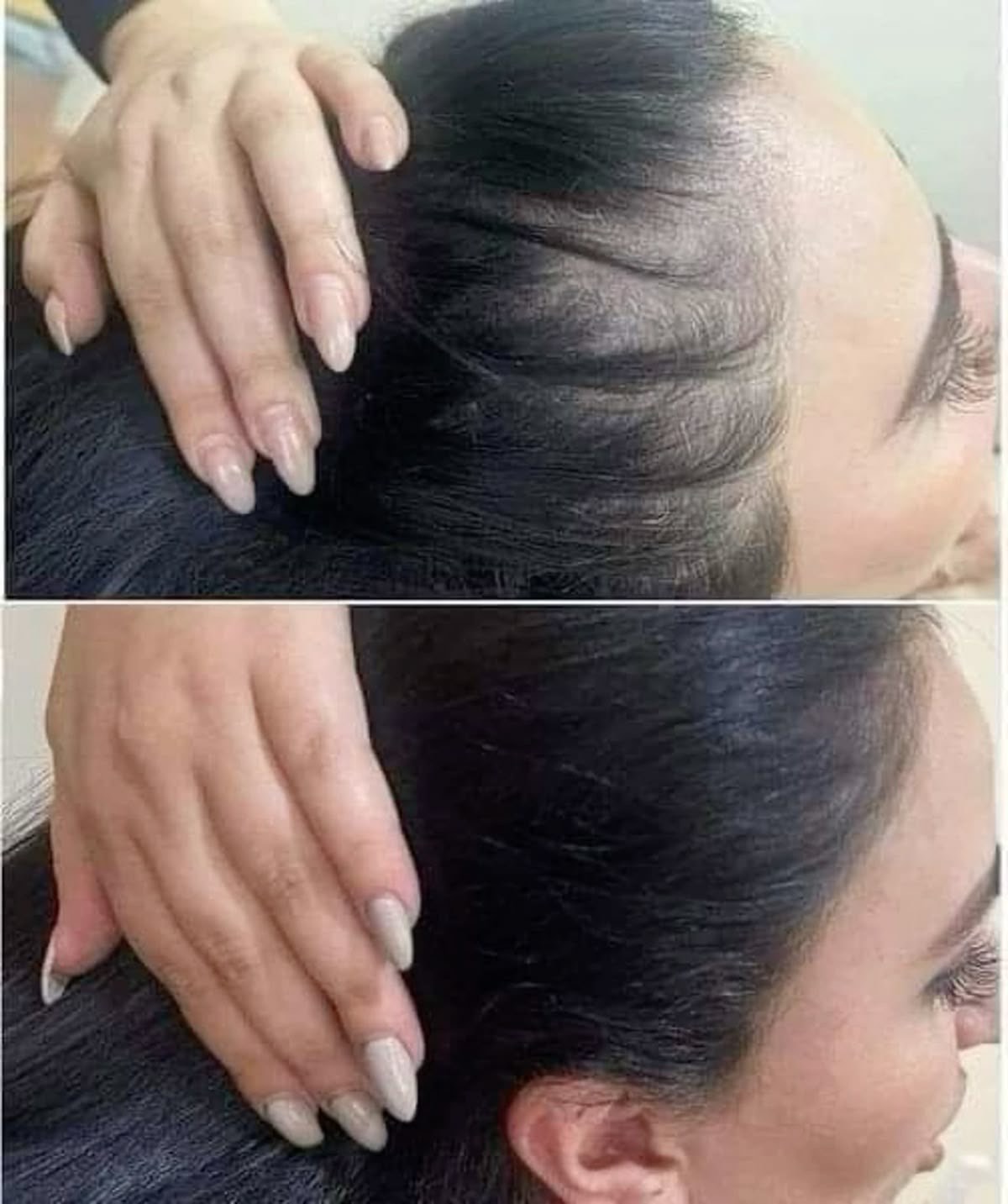 Keratin niqobi sochlarning o‘sishi va uzunligini oshiradi soch to‘kilishiga qarshi