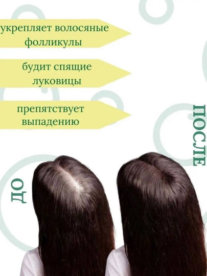 TRICHUP шампунь при выпадение перхоти седины,без сульфатов, кератин усма черный тмин