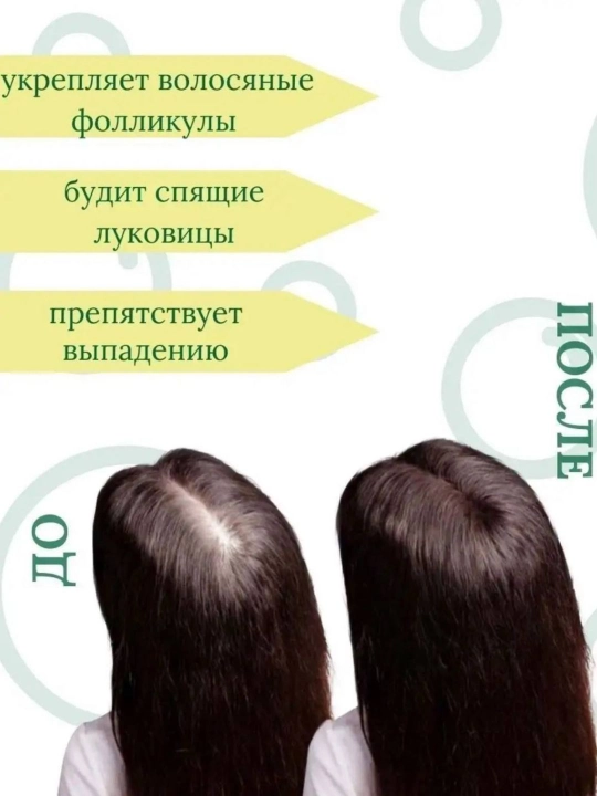 TRICHUP шампунь при выпадение перхоти седины,без сульфатов, кератин усма черный тмин