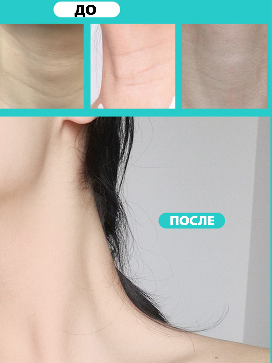 Невидимые патчи - тейпы для шеи против морщин, омолаживающие 5 штук 