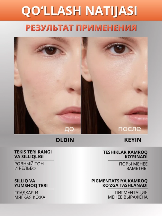ICON SKIN terini yangilash uchun kislotalar va peptidlar bilan professional piling, 30 ml